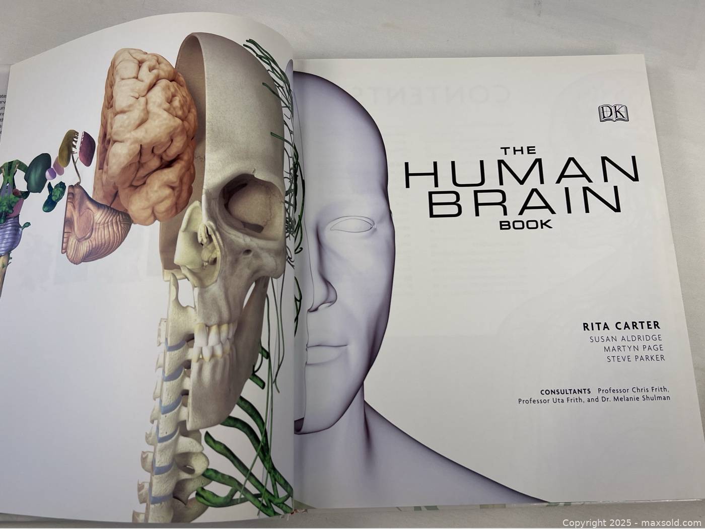 The Human Brain Book with DVD-ROM | Maxsold